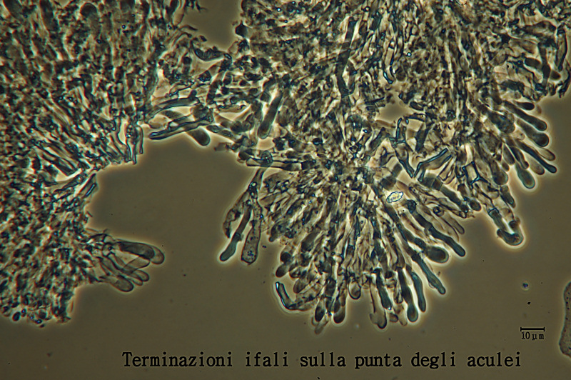 Hyphodontia breviseta (P. Karst.) J. Erikss.